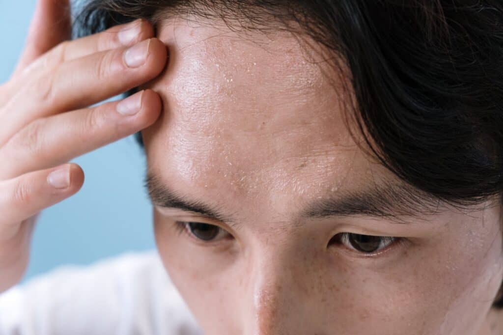 man touching sweaty forehead